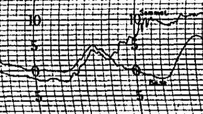 Primeras observaciones de los años 1890 à 1994